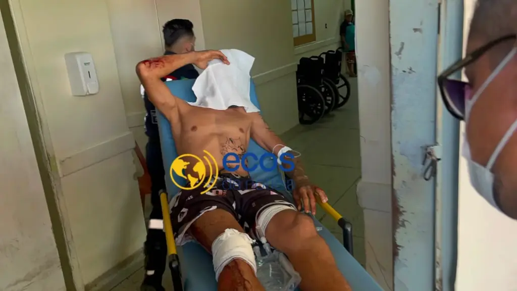 Motociclista é baleado durante tentativa de assalto na Transacreana em Rio Branco