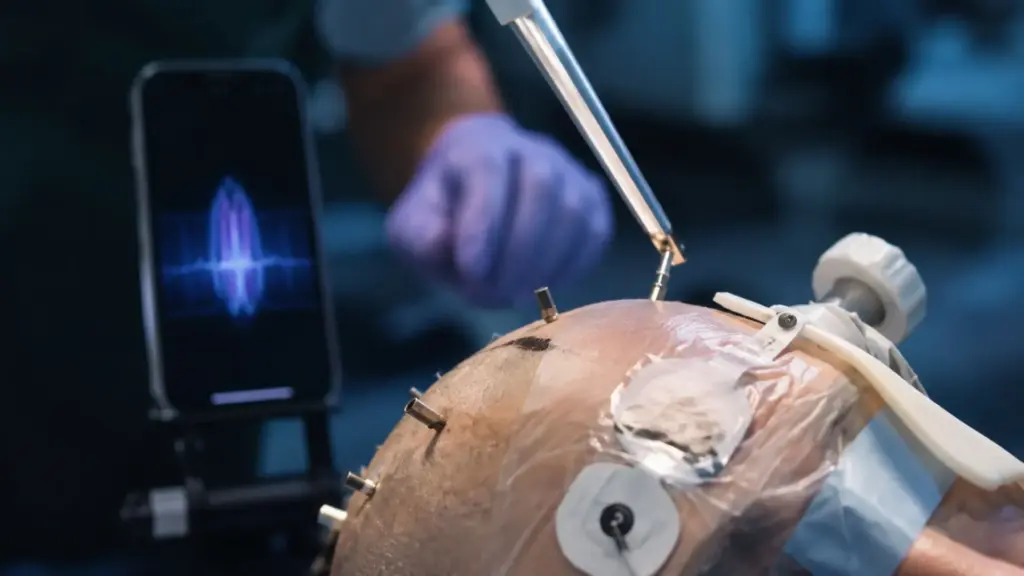 Celular controlado pelo pensamento pode deixar a ficção após China implantar oito eletrodos capazes de captar neurônios individuais, enquanto sistema ainda precisa aprender a converter intenções como alcançar ou andar em comandos para máquinas externas em novos testes clínicos chineses