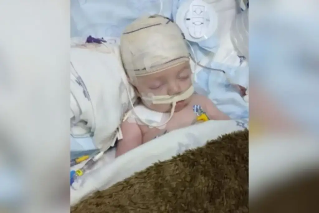 Aos 4 anos, menino já passou por três cirurgias desde bebê por causa de uma epilepsia que os remédios não conseguem controlar, e agora os pais correm atrás de R$ 59 mil para bancar o próximo procedimento Aos 4 anos, menino já passou por três cirurgias desde bebê por causa de uma epilepsia que os remédios não conseguem controlar, e agora os pais correm atrás de R$ 59 mil para bancar o próximo procedimento