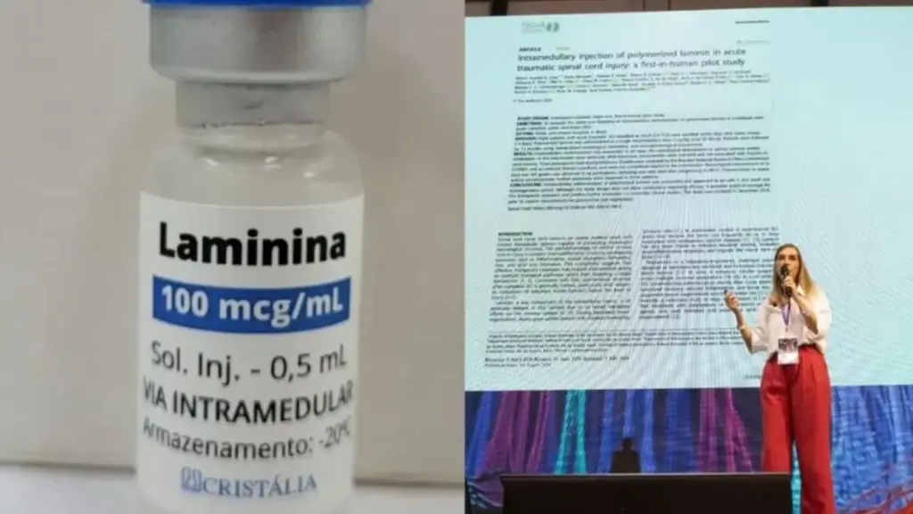 Polilaminina brasileira apresenta melhora neurológica em 6 de 8 pacientes com lesão medular completa, resultado de 75% no primeiro estudo em humanos, e pesquisa da UFRJ ganha publicação na revista científica internacional Spinal Cord enquanto novos testes avançam no Brasil