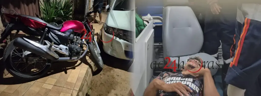 Motociclista perde controle ao fazer ‘grau’ e bate de frente com carro sofre fratura em Rio Branco Motociclista perde controle ao fazer ‘grau’ e bate de frente com carro sofre fratura em Rio Branco