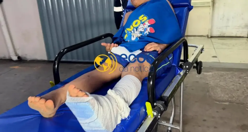 Criança de 8 anos é atropelada no Segundo Distrito e motociclista sofre amputação de dedo Criança de 8 anos é atropelada no Segundo Distrito e motociclista sofre amputação de dedo