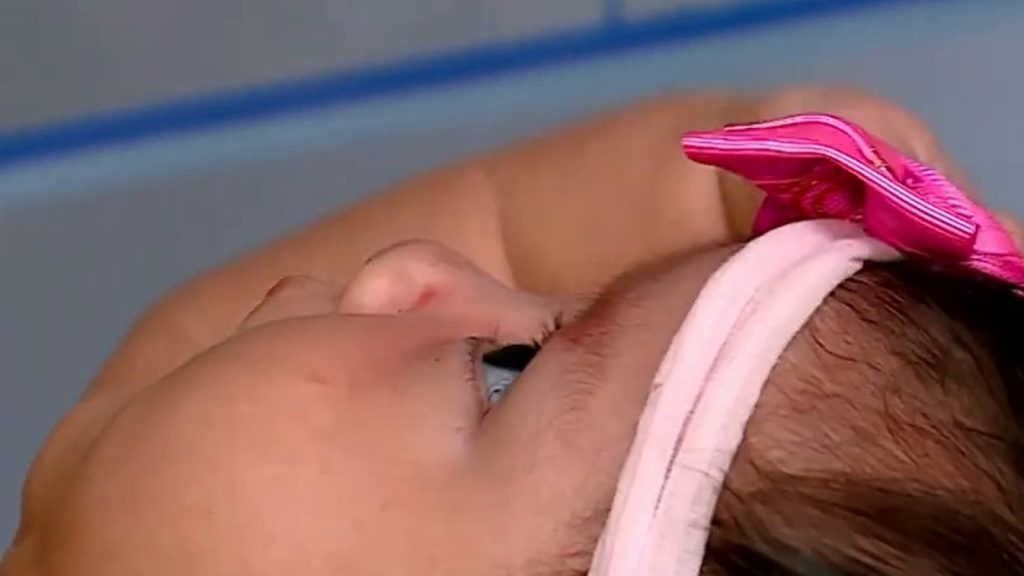 Um bebê prematuro só teve o exame que evita cegueira pedido 55 dias depois de nascer, na 8ª semana em vez da 6ª, e em 2026 uma decisão mandou um hospital pagar pensão para o resto da vida dele por “falha no atendimento”