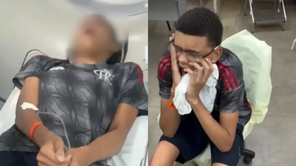 Jovem boceja, desloca a mandíbula e precisa ser levado de ambulância para outro hospital em Brasília após primeira unidade não ter especialista para recolocar a articulação no lugar Jovem boceja, desloca a mandíbula e precisa ser levado de ambulância para outro hospital em Brasília após primeira unidade não ter especialista para recolocar a articulação no lugar