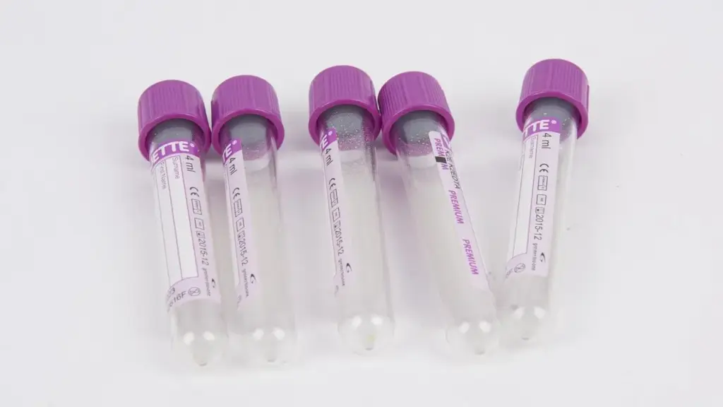 Trabalhadora que desmaiou no cheiro forte de tinta durante a reforma teve sangue colhido sem autorização no atendimento, recebeu um resultado de gravidez que nunca havia pedido, foi dispensada ainda na experiência e vai receber R$ 20 mil Trabalhadora que desmaiou no cheiro forte de tinta durante a reforma teve sangue colhido sem autorização no atendimento, recebeu um resultado de gravidez que nunca havia pedido, foi dispensada ainda na experiência e vai receber R$ 20 mil