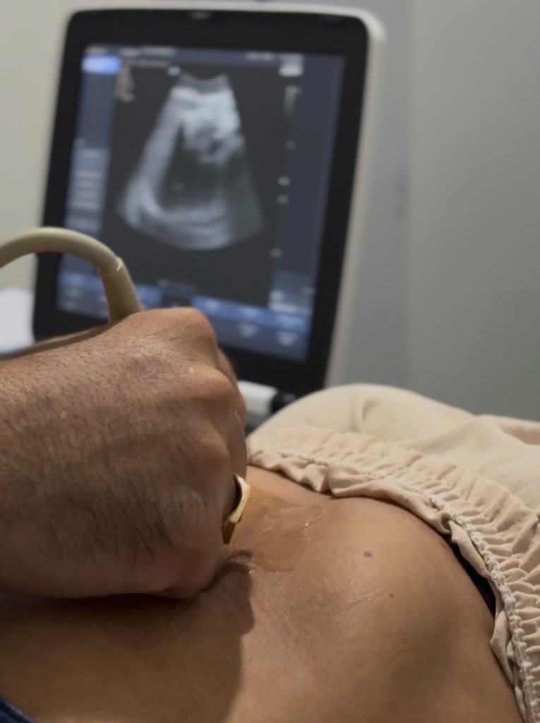 PREFEITURA INICIA ATENDIMENTO DO PROGRAMA FILA ZERO E AMPLIA ACESSO DA POPULAÇÃO A EXAMES E MÉDICOS ESPECIALISTA EM RODRIGUES ALVES