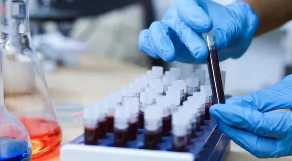 Exame de sangue capaz de diagnosticar o Alzheimer chega ao Brasil