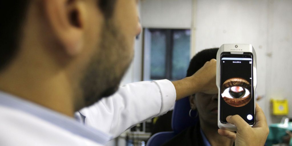 Retinopatia: doença ocular afeta um em cada três diabéticos Retinopatia: doença ocular afeta um em cada três diabéticos